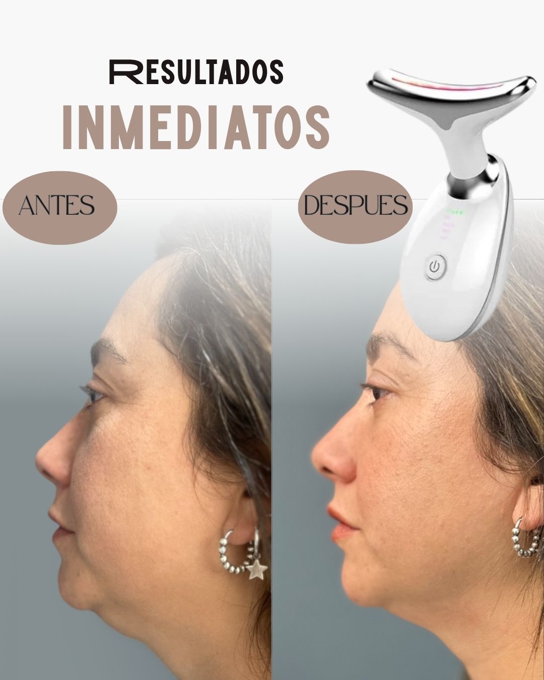 ReafirmaSkin™ – Reduce papada| Mejora circulación facial