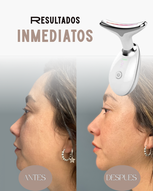 ReafirmaSkin™ – Reduce papada| Mejora circulación facial