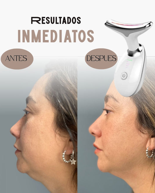 ReafirmaSkin™ – Reduce papada| Mejora circulación facial